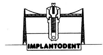 IMPLANTODENT