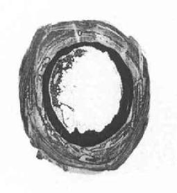 M2518238