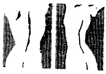 M1778921