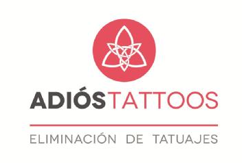 ADIOS TATTOOS ELIMINACION DE TATUAJES