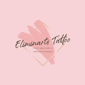 Eliminarte Tattoo Centro especializado en eliminación de tatuajes