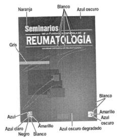 Imagen de SEMINARIOS DE LA FUNDACION ESPAÑOLA DE REUMATOLOGIA SOCIEDAD ESPAÑOLA DE REUMATOLOGIA