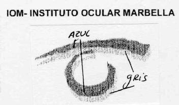 Imagen de IOM - INSTITUTO OCULAR MARBELLA