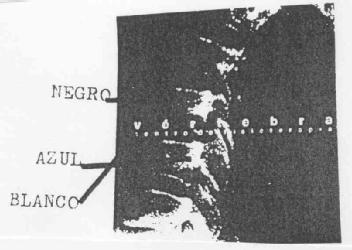 Imagen de VERTEBRA