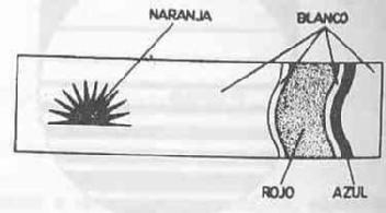 Imagen de M1214824