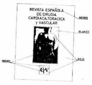 Imagen de REVISTA ESPAÑOLA DE CIRUGIA CARDIACA, TORACICA Y VASCULAR CTV
