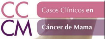 Imagen de CC CM CASOS CLINICOS DE CANCER DE MAMA