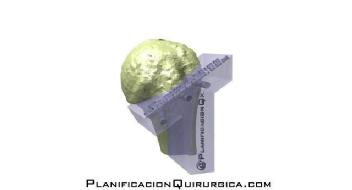 Imagen de PlanificacionQuirurgica.com