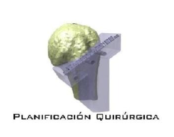 Imagen de PLANIFICACIÓN QUIRÚRGICA