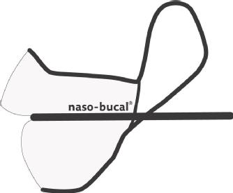 Imagen de naso-bucal