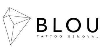 Imagen de BLOU TATTOO REMOVAL